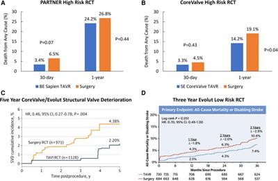 Commentary: The safety and efficacy of balloon-expandable vs. self-expanding trans-catheter aortic valve replacement in high-risk patients with severe symptomatic aortic stenosis